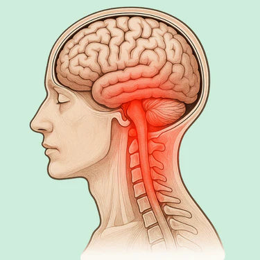 Neuroinflammation
