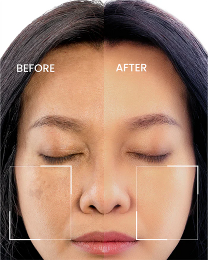 Dark Spot Corrector