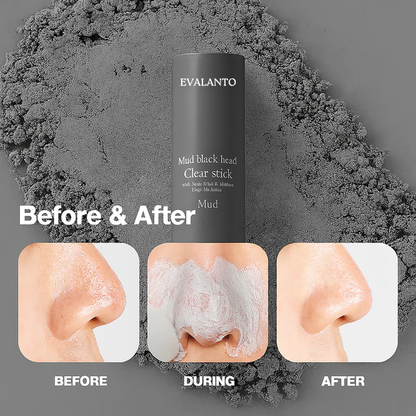 Luvare™ Mud Pore Detox Stick